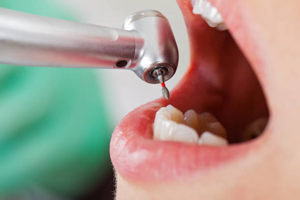 Best Pediatric Emergency Dentist in Thief River Falls, MN